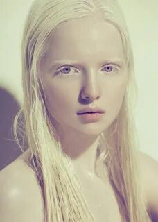 KIMI ZHIDKOVA City Models Albino model, Albino girl, Beauty