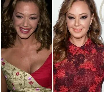 Leah Remini Plastic Surgery - With Before And After Photos