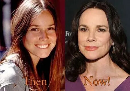 Barbara Hershey Plastic Surgery: Before and After Facelift