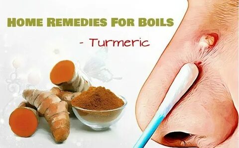 Home remedies for boils and cysts on face, back or leg