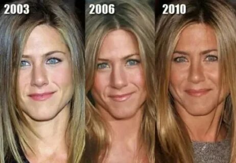 Before and After Plastic Surgery - Jennifer Aniston Дженнифе