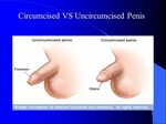 Circumcised Vs Uncircumcised Porn Sex Pictures Pass
