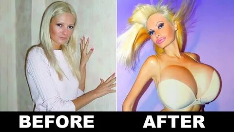 10 Extreme Plastic Surgery Transformations - YouTube