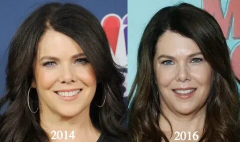 lauren-graham-2014-2016 - Latest Plastic Surgery Gossip And 