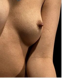 Goosebumps boobs.