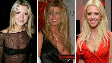 Tara Reid and Other Stars Who Have Had Plastic Surgery.
