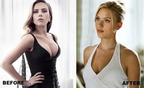 Scarlett Johansson breast reduction - Plastic Surgery Facts