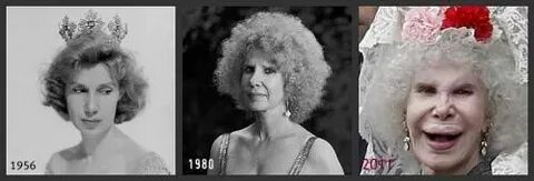 The Duchess Of Alba Plastic Surgery