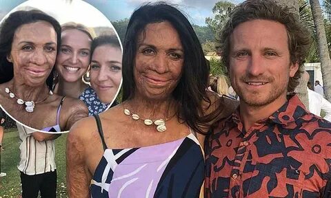 Turia Pitt marvels over fiancé Michael Hoskin's outfit