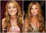 Top 10 Worst Celebrity Plastic Surgery Disasters from Hollyw