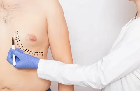 Enlarged Breasts In Men - Gynecomastia - Viral Rang.
