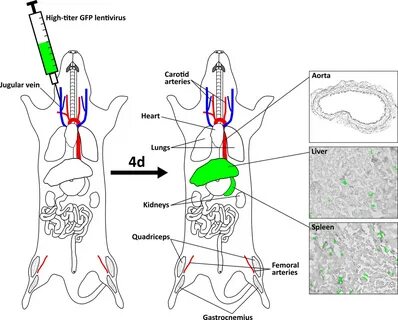 Jugular Vein Injection of High-Titer Lentiviral Vectors Does Not.