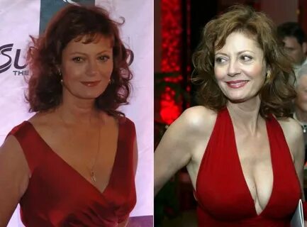 Susan Sarandon Plastic Surgery: Success Or Fail?