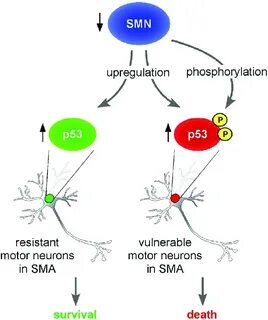 Model of Motor Neuron Death in SMA Schematic summary of the 