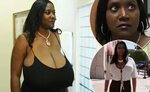 Hope for Nigeria Texas woman gets breast reduction from '36N