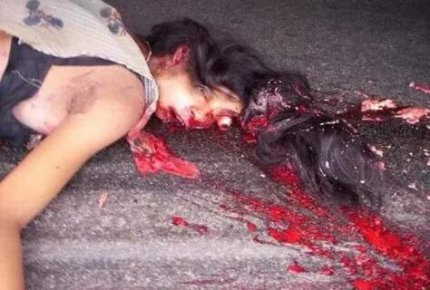Nasty effects of road accidents (caution very graphic and po