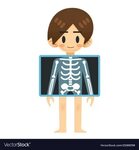 Patient man with x-ray screen Royalty Free Vector Image