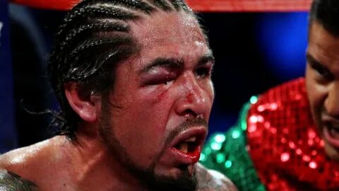 Antonio Margarito: The Train wreck We Just Can’t Look Away F