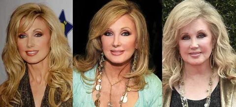 Morgan Fairchild Plastic Surgery Before and After Pictures 2
