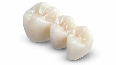 ZIRCONIA CROWNS, ZIRCONIA BRIDGES, ZIRCONIUM В СТОМАТОЛОГИИ