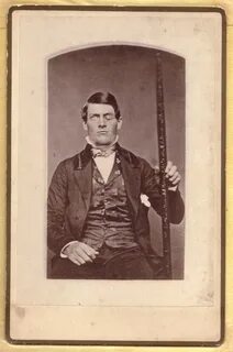 File:Phineas Gage GageMillerPhoto2010-02-17 Unretouched Colo