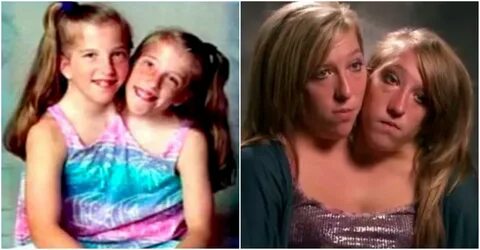 Here's What Conjoined Twins Abby And Brittany Hensel Look Li
