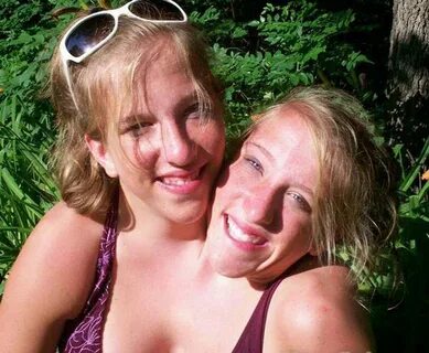 Abby And Brittany Hensel, British Most Famous Conjoined Twin