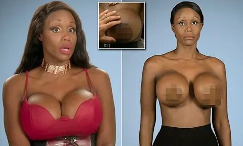 Professional 'sugar baby' whose nipple DOUBLED in size refus