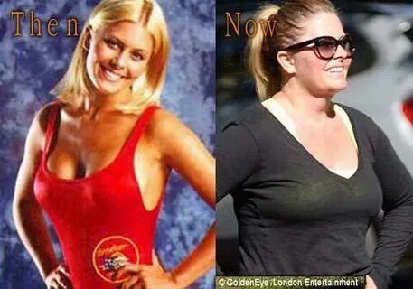 Nicole Eggert Plastic Surgery, Before and After Pictures