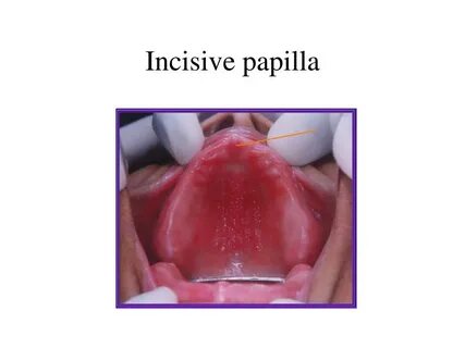 PPT - Introduction in Prosthodontics (dental prosthetics) Po