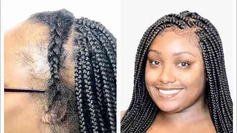 Thin Hair Braids - 25 Short Box Braids Styles To Try Right N