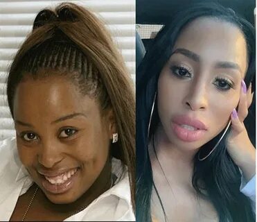 African Celebrities Who Have Undergone Plastic Surgery - Pag