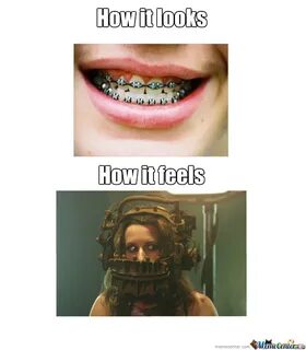 Funny braces Memes