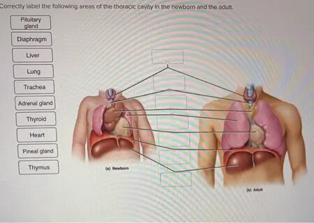 Solved Correctly label the following area of the thoracic Ch