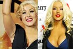 7 Голливудских знаменитостей, пойманных на "пластике" с поли