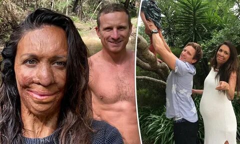 Turia Pitt Husband - Go Images Road