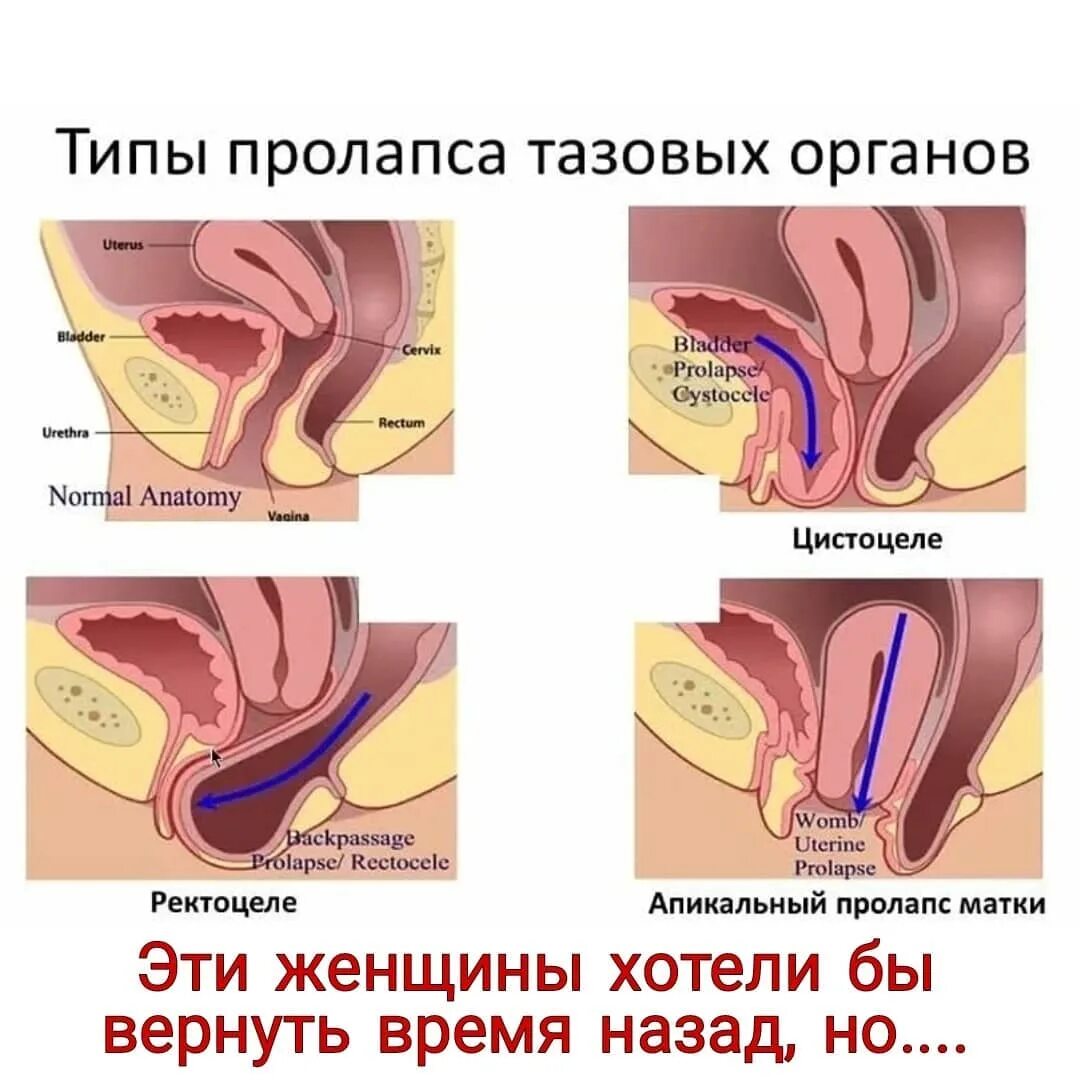 оргазм при опущении матки фото 87