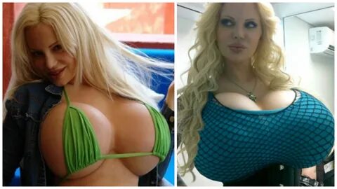 10 Horrifyingly Awkward Boob Modifications.