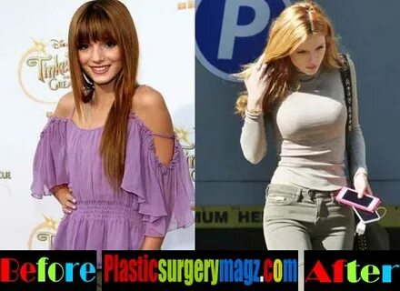 Bella Thorne Plastic Surgery Breast Before and After Plastic