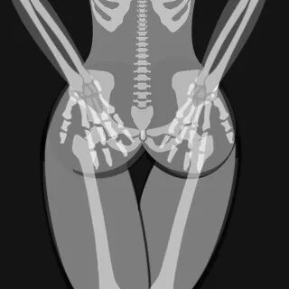 X-ray Thread @notop - /r/ - Adult Request - 4archive.org