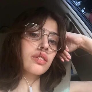 Social Media Star Claire Wineland, 21, Dies a Week After Und