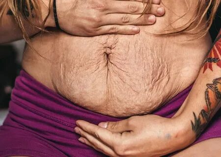 Photos Of Real Mom Bodies: A Trend We Should Get Behind Chat