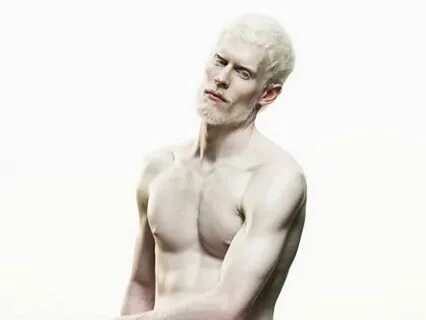 stephen thompson Stephen thompson, Albino model, Albino men