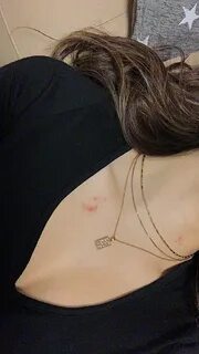 #love #lovebites #hickeys #couples #couplegoals Swag girl st