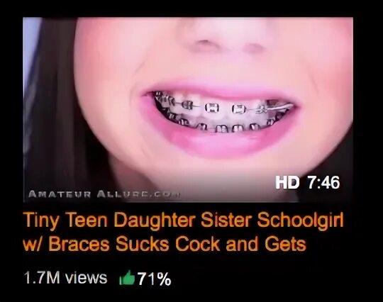 Braces Fetish Stories - Porn photos HD and porn pictures of 