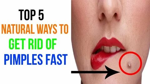 How to Get Rid of Pimples Fast - Top 5 Natural Ways To Get R