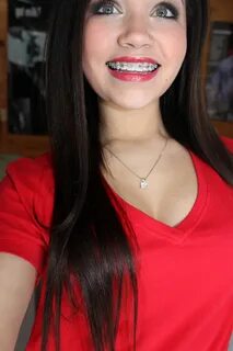 Red Lips With Braces