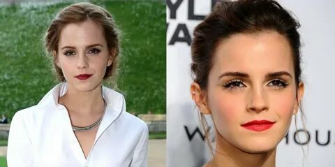 Emma Watson Plastic Surgery