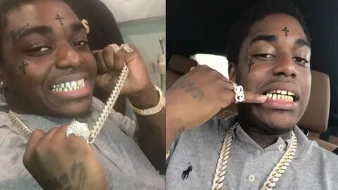 Kodak Black Gold Teeth Permanent posted by Michelle Anderson