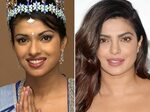 Priyanka Chopra, Before and After Celebrities before and aft